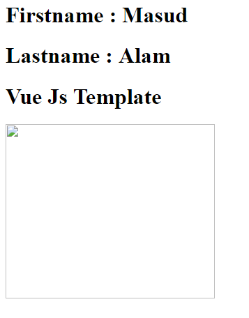 VueJS Image Template Syntax